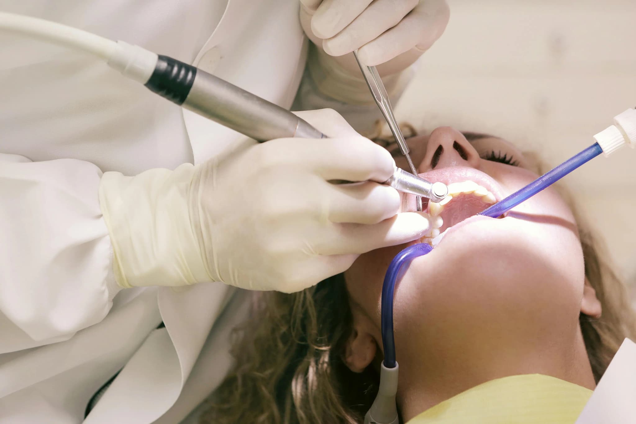What Happens to Your Teeth When You Skip Dental Cleanings
