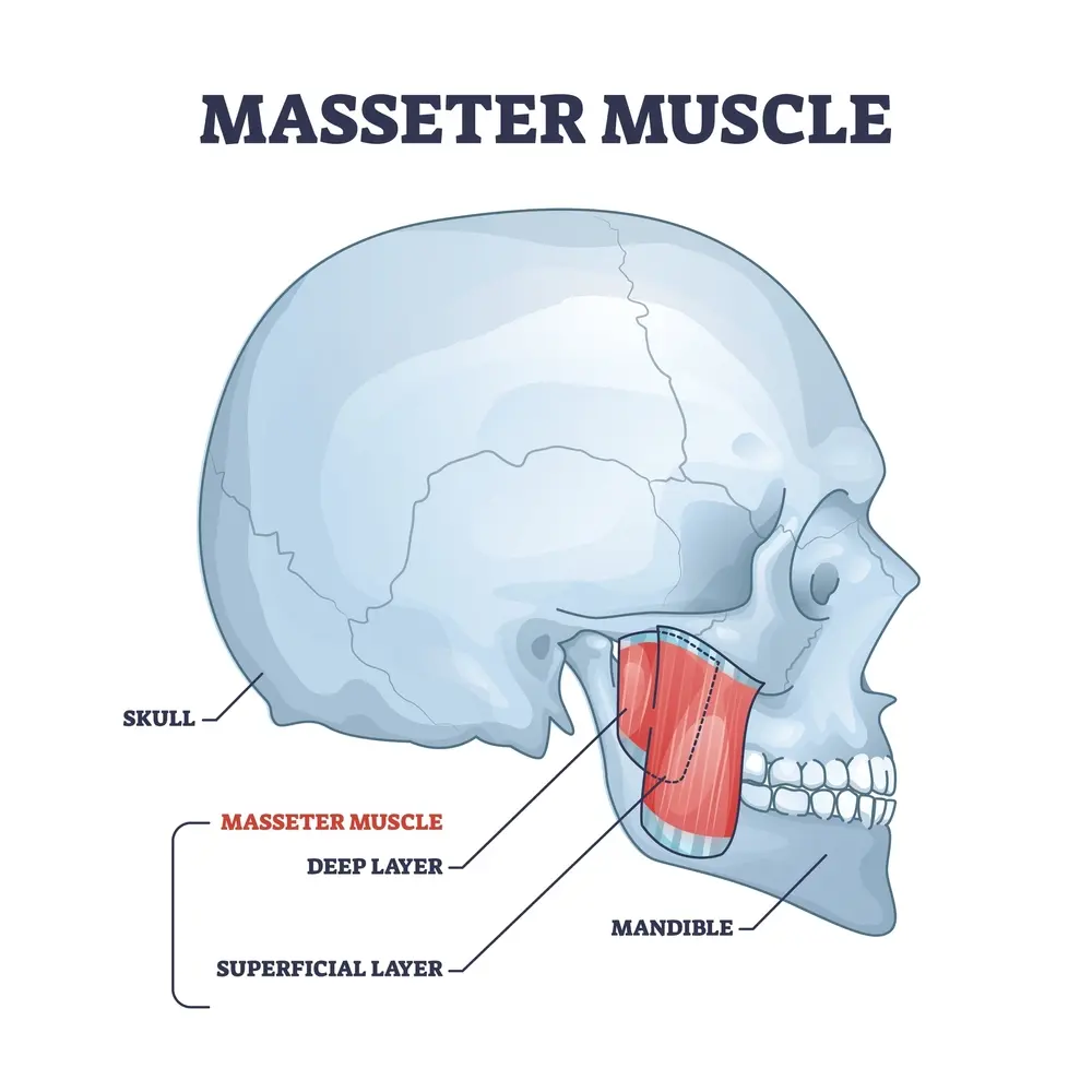 Masseter Botox: Jaw Slimming and TMJ Relief in One Treatment