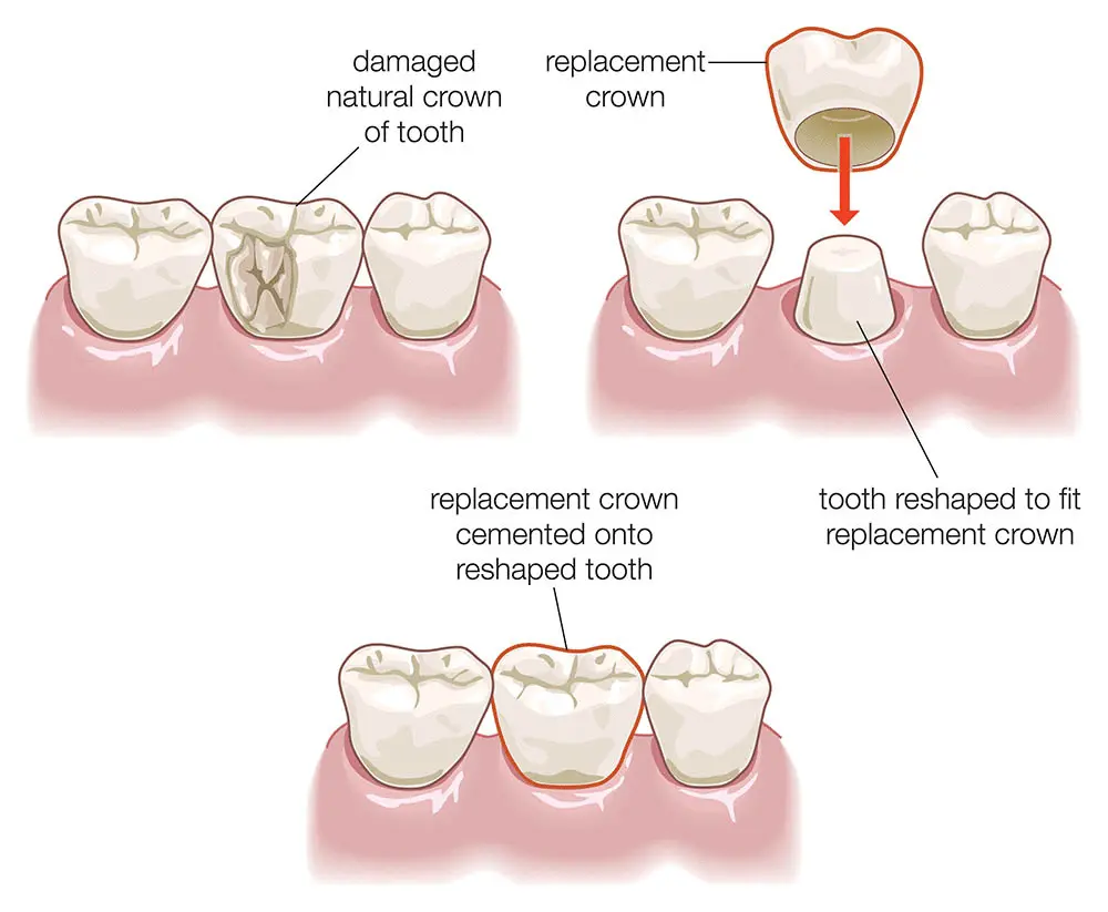 Spire Dental Care