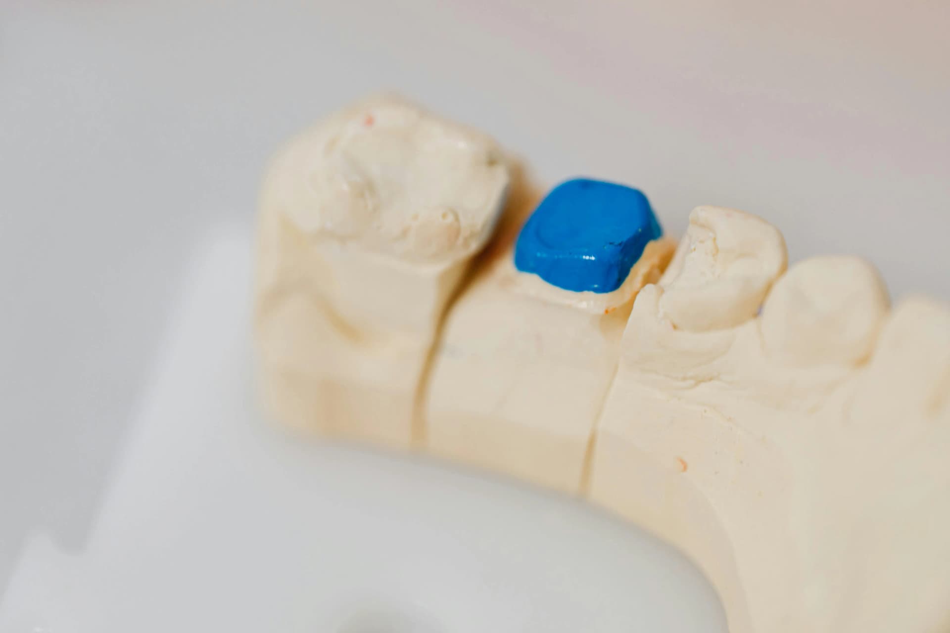 Dental Restorations