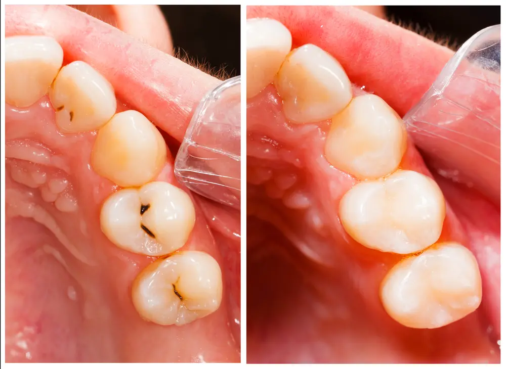 Spire Dental Care