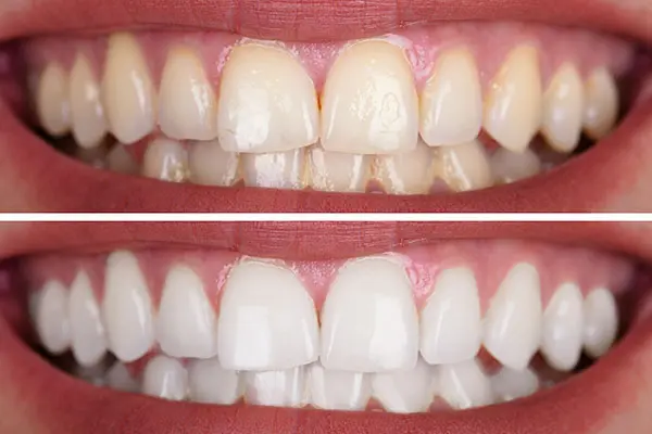 Spire Dental Care