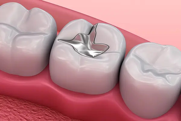 Spire Dental Care