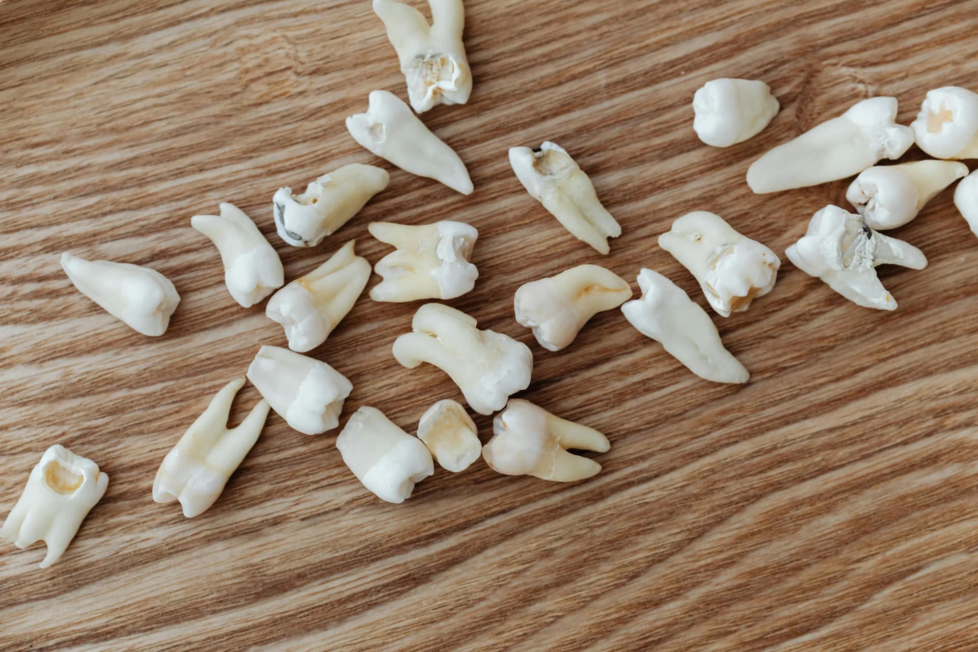 Teeth Extractions
