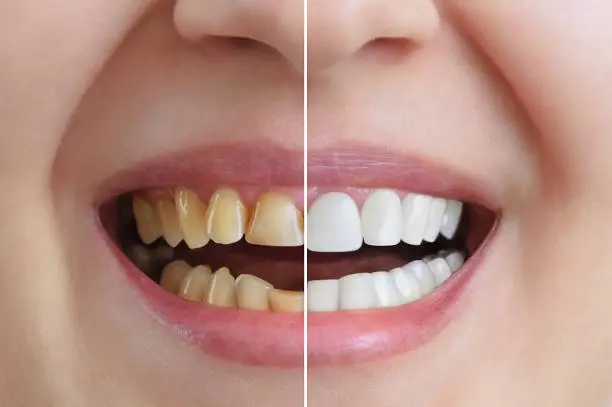 Cosmetic Dentistry at Spire Dental Care