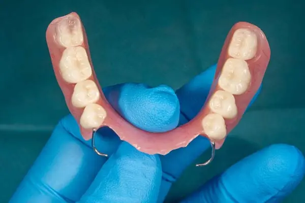 Dentures at Spire Dental Care in Langley, BC